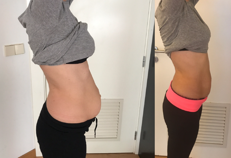 Antes e depois