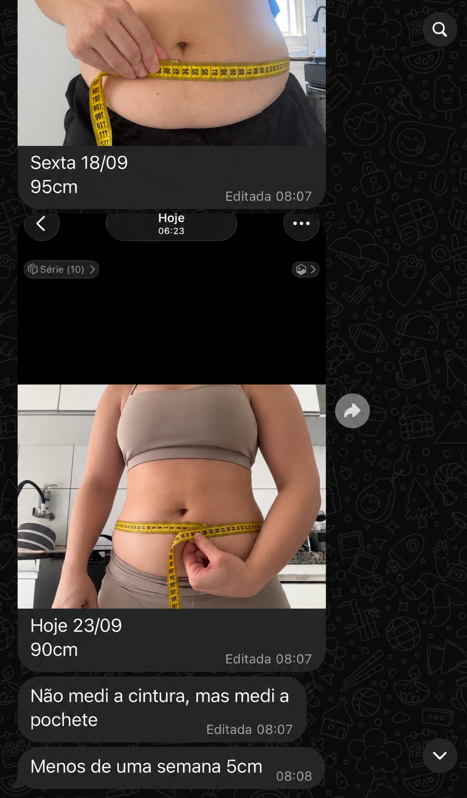 Antes e depois Mirela