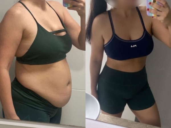 Antes e depois