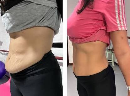 Antes e depois